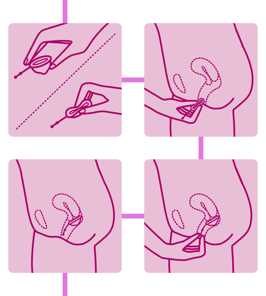 Step by step of how to use a menstrual disc